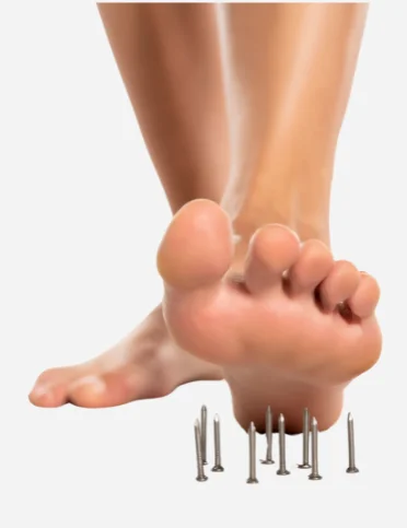 pied s'apprêtant à marcher sur un corps étranger au pied nécessitant la consultation avec nos podiatres à Gatineau