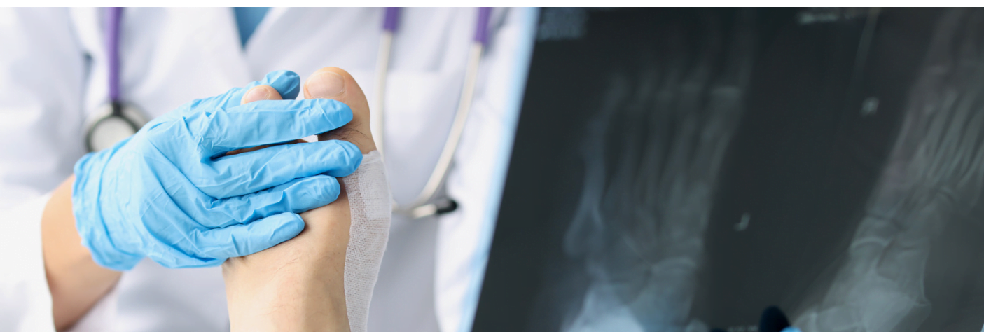 Main sur un pied d'un podiatre de la clinique Mon Podiatre Gatineau et radiographie